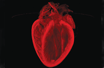 anatomical scan of a heart