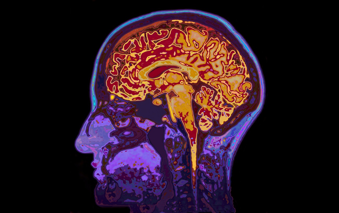 A scan of a brain